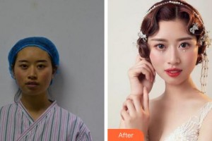 溫州藝星醫(yī)學(xué)美容醫(yī)院黃艷軍整形價格表附抗衰案例展示