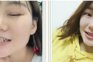 嘉興牙博士口腔門(mén)診部馬楠整形價(jià)格表附牙齒隱形矯正案例展示