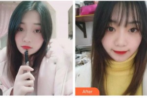 臺州拜博口腔醫(yī)院王學俠整形價格表附牙齒隱形矯正案例展示
