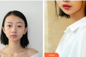 樂山金手指醫(yī)學(xué)美容診所岑曉勇整形價(jià)格表附鼻部綜合案例展示