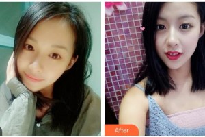 樂山王玉琨皮膚病?？漆t(yī)院張麗整形價(jià)格表附眼部綜合案例展示