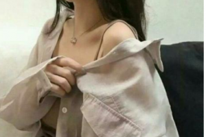 長春醫(yī)美整形美容醫(yī)院梁中偉整形價格表附埋線提升案例展示