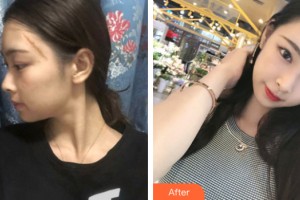 海南整形美容醫(yī)院馬文熙教授，整形價(jià)格表附皮膚美容案例展示