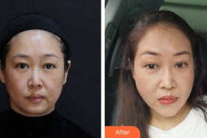 海南夢妮幻整形?？崎T診部何濤整形價(jià)格表附皮膚美容案例展示