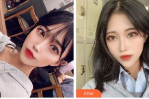 昆明吳氏嘉美美容醫(yī)院莊蔚強整形價格表附鼻部綜合案例展示