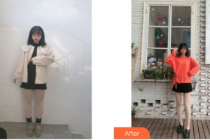 南寧市第七人民醫(yī)院整形美容科黎石峰整形價(jià)格表附大腿吸脂案例展示