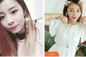 昆明藍(lán)橙口腔醫(yī)院王曉惠整形價格表附隱形托槽矯正案例展示