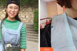 昆明愛齊口腔門診部朱婭整形價格表附牙齒隱形矯正案例展示