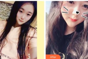 曲靖韓美醫(yī)療美容門診部（原靖美）呂朋梟整形價格表附金屬托槽矯正案例展示