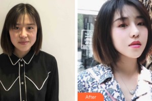 武漢百佳婦產醫(yī)院醫(yī)療美容科馬曉宜整形價格表附皮膚美容案例展示