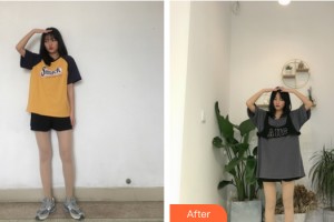 武漢美侖醫(yī)療美容門診部陳遠海整形價格表附大腿吸脂案例展示