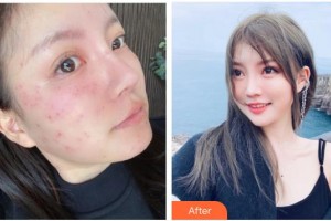 石家莊黛芙醫(yī)療美容診所戴輝整形價格表附激光祛斑案例展示