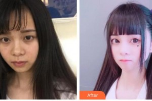 唐山開灤醫(yī)院整形美容中心饒穎慧整形價格表附激光去黑眼圈案例展示