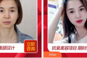 唐山聯(lián)合麗珍醫(yī)療美容門診部金承泰整形價(jià)格表附埋線提升案例展示