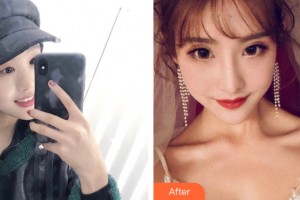 ?？诩t妝尚醫(yī)療美容門診部關(guān)海濤整形價(jià)格表附眼部手術(shù)案例展示