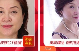 秦皇島紀(jì)輝整形美容醫(yī)院朱改芬整形價(jià)格表附皮膚修復(fù)案例展示