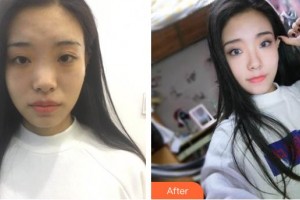 滄州楓華醫(yī)療美容診所林敬華整形價(jià)格表附鼻部綜合案例展示