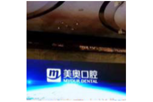 烏魯木齊牙科收費標(biāo)準(zhǔn)  烏魯木齊美奧口腔門診牙齒美白恢復(fù)圖