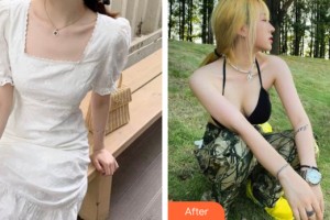 貴陽美和諧醫(yī)療美容門診部馮斌整形價格表附隆胸手術(shù)案例展示