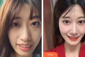 貴陽柏德口腔門診部任義整形價格表附牙齒矯正案例展示