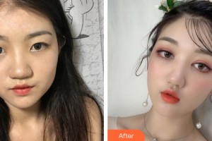 貴陽應(yīng)超小李飛刀醫(yī)療美容醫(yī)院吳光宇整形價格表附眼部手術(shù)案例展示