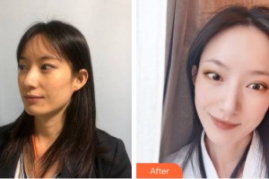 貴陽(yáng)美和諧醫(yī)療美容門(mén)診部孟永利整形價(jià)格表附皮膚美容案例展示