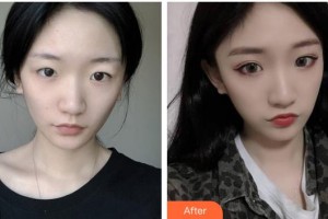 大同美神整形美容醫(yī)院王玉秀整形價格表附祛斑祛痣案例展示