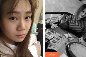 大同魅力舍賓美容診所梁冬明整形價格表附假體隆鼻案例展示