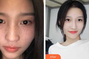 三亞瑞希醫(yī)學(xué)美容門診部葉育成整形價(jià)格表附皮膚美容案例展示