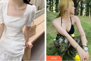 西寧時光整形醫(yī)院祁永章整形價格表附隆胸手術案例展示