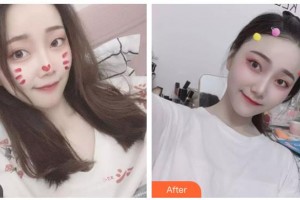 內(nèi)蒙古林業(yè)總醫(yī)院燒傷整形科姚荔湘整形價格表附紅藍(lán)光祛痘案例展示