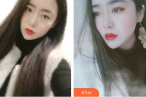 南昌時光醫(yī)療美容門診部郭立合整形價格表附牙齒矯正案例展示