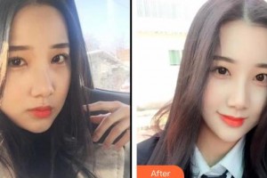 包頭貝特瑞爾口腔門(mén)診部劉金龍整形價(jià)格表附冷光美白案例展示