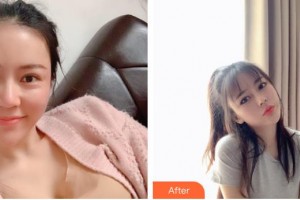 包頭貝特瑞爾口腔門(mén)診部安順凱整形價(jià)格表附美白劑美白牙齒案例展示