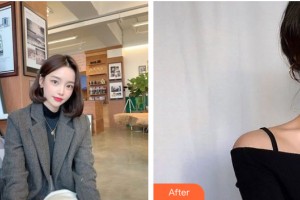 新疆大西北醫(yī)學美容醫(yī)院李大鐵整形價格表附皮膚美容案例展示