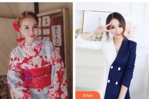 常熟金山整形美容門診部陳昌弛整形價(jià)格表附紅藍(lán)光祛痘案例展示