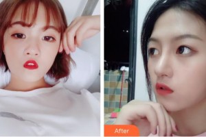 桂林市中醫(yī)醫(yī)院眼科陳基生整形價格表附定點雙眼皮案例展示