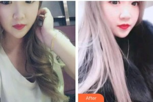 江陰牙博士口腔門診部董偉鵬整形價(jià)格表附金屬托槽矯正案例展示