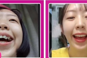 江陰牙博士口腔門(mén)診部于庭波整形價(jià)格表附金屬托槽矯正案例展示