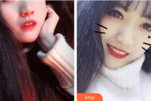 江陰牙博士口腔門(mén)診部蔡正飛整形價(jià)格表附美白劑美白牙齒案例展示