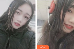 ?？诤佳谰S信口腔門診部方略宇整形價格表附牙齒隱形矯正案例展示
