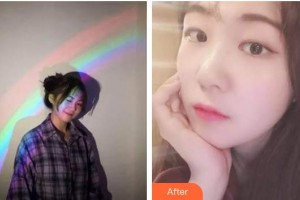 ?？诤佳谰S信口腔門診部曾婷整形價格表附超聲波潔牙案例展示