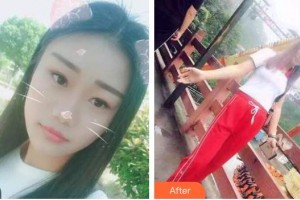 海口望?？谇婚T診部陳新整形價格表附美白貼片案例展示