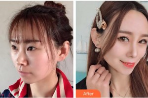 ?？诩t妝尚醫(yī)療美容門診部吳健整形價格表附眼部綜合案例展示