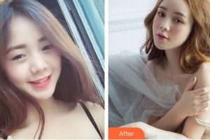 十堰愛爾眼科醫(yī)院王曙亮整形價(jià)格表附眼部綜合案例展示