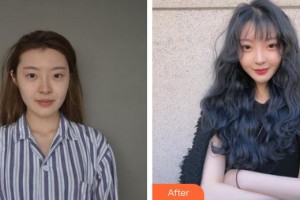 十堰愛爾眼科醫(yī)院王勇整形價格表附眼部修復(fù)案例展示