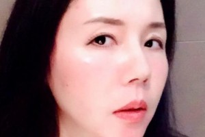 贛州何勤口腔診所李德艷整形價(jià)格表附牙齒矯正案例展示