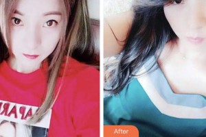荊門(mén)小白兔口腔醫(yī)院徐小蔓整形價(jià)格表附超聲波潔牙案例展示