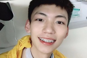 上海九院口腔科邱蔚六牙齒矯正果太好了附果圖和價(jià)目表