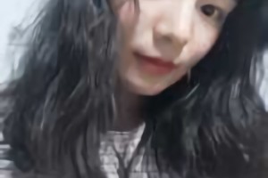 北京圣嘉榮醫(yī)療美容醫(yī)院磨骨好不好？附黃大勇磨骨案例